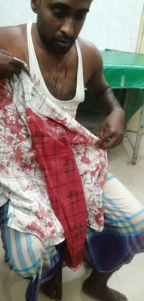 চাঁদপুরে মাদক ব্যবসায়ী খোরশেদের হামলায় দুই ভাই গুরুতর আহত