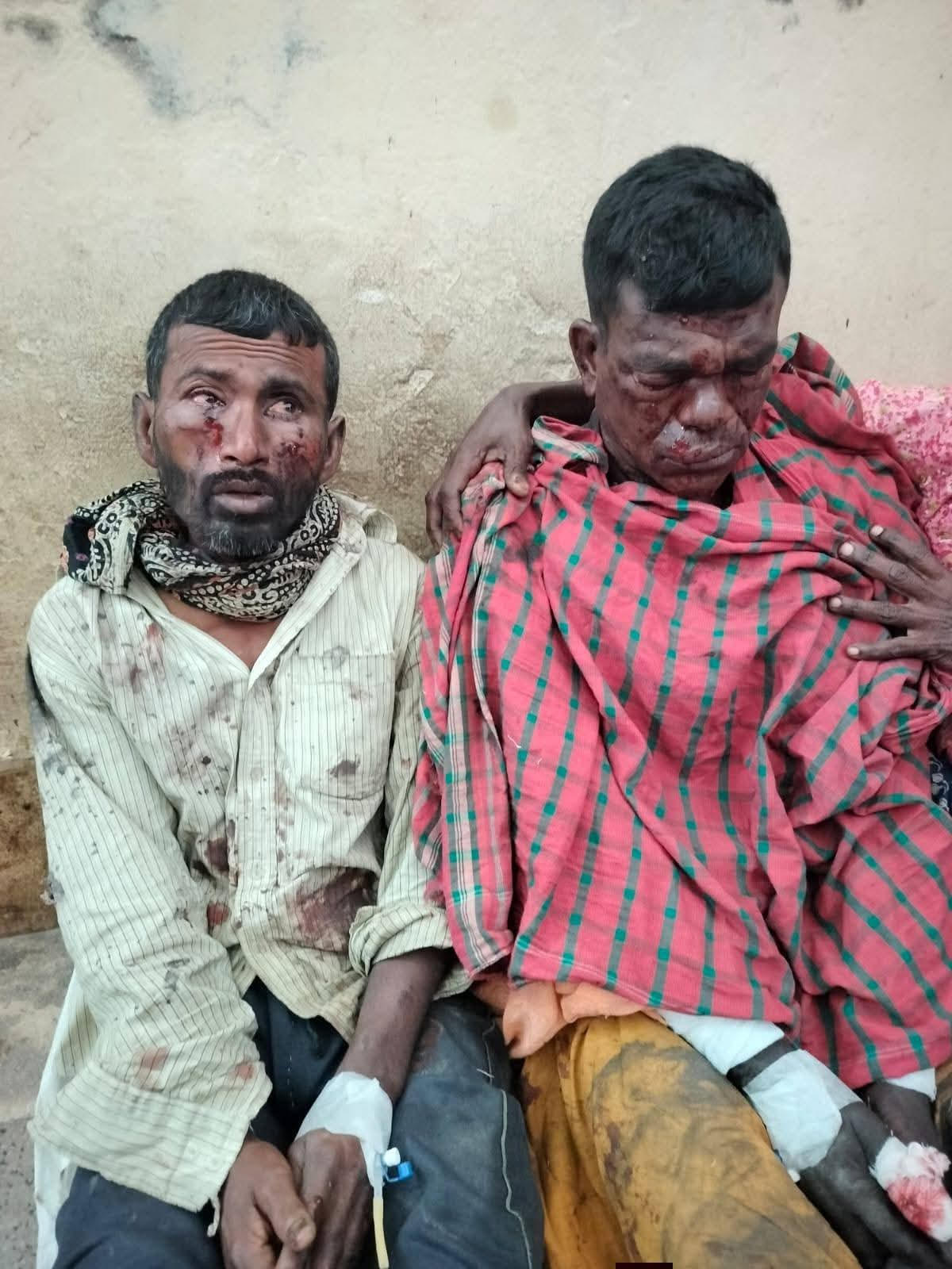 বেনাপোল বোমা বিস্ফোরণে ৩ শ্রমিক আহত